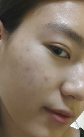 첨부이미지