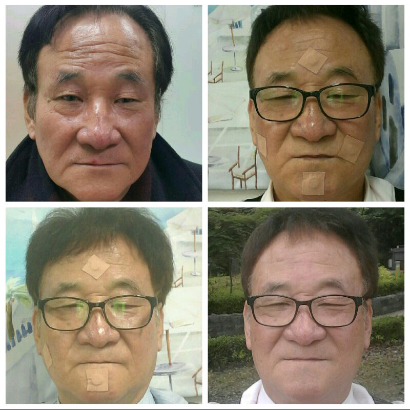 블로그 이미지